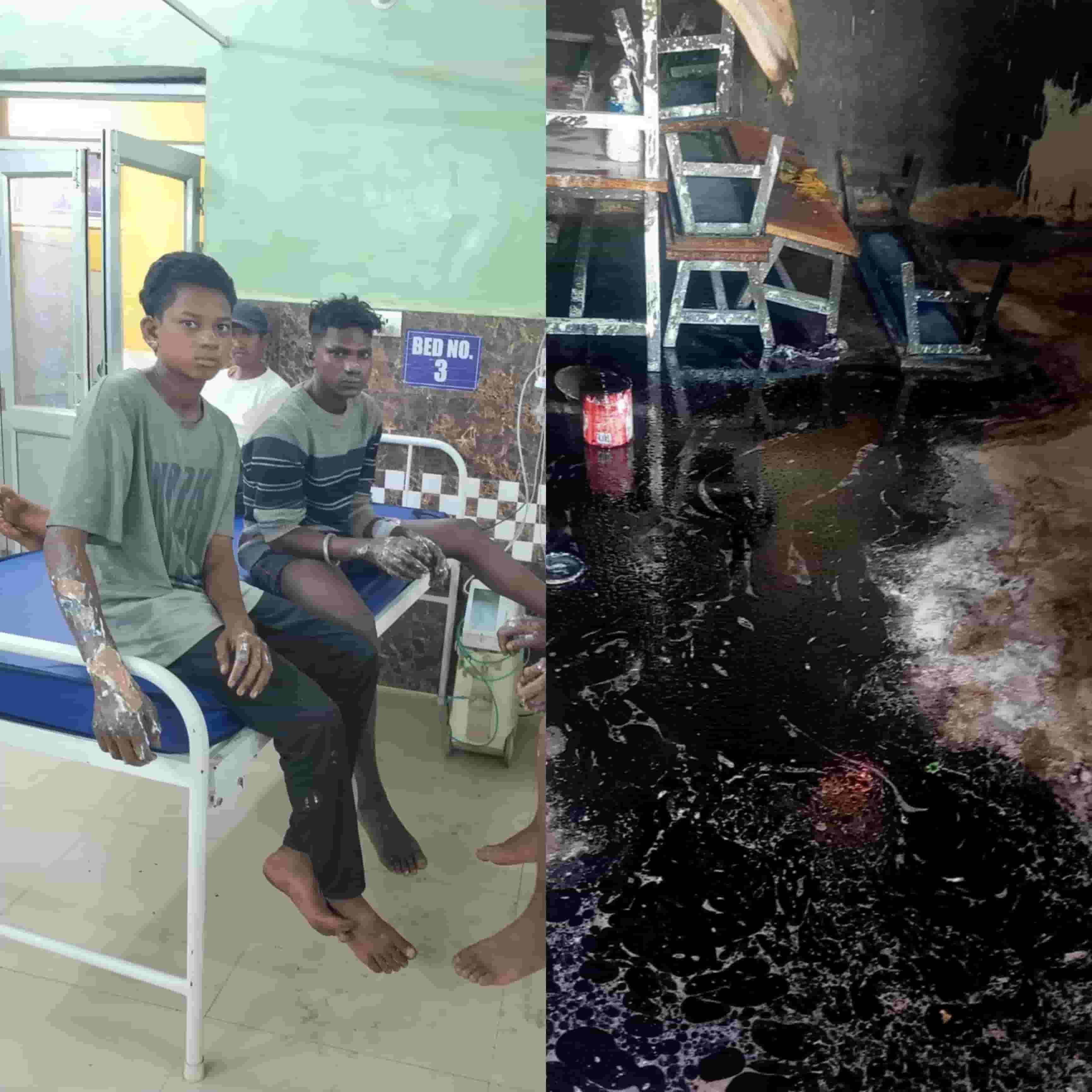 स्कूल में पेंटिंग के दौरान हादसा, तारपीन तेल में आग से पांच मजदूर झुलसे, एक नाबालिग शामिल